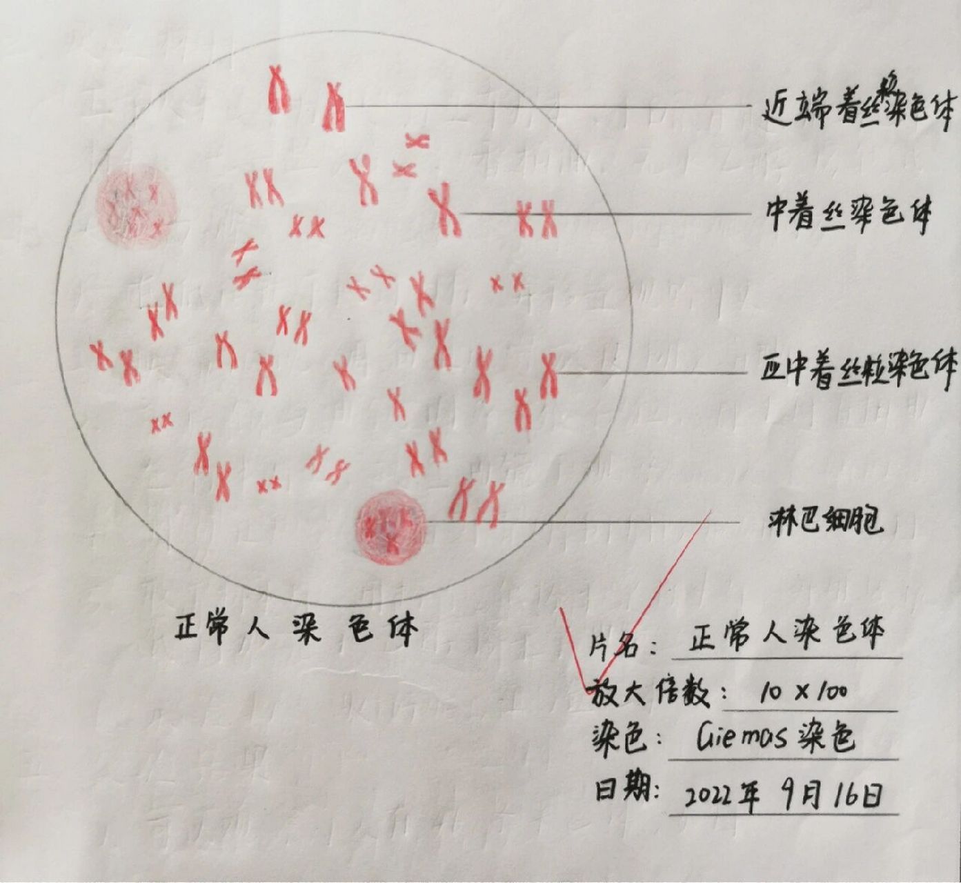 姐妹染色单体图解图片