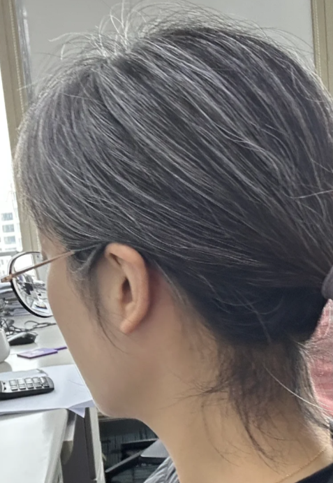 为什么有白头发 为什么有白头发