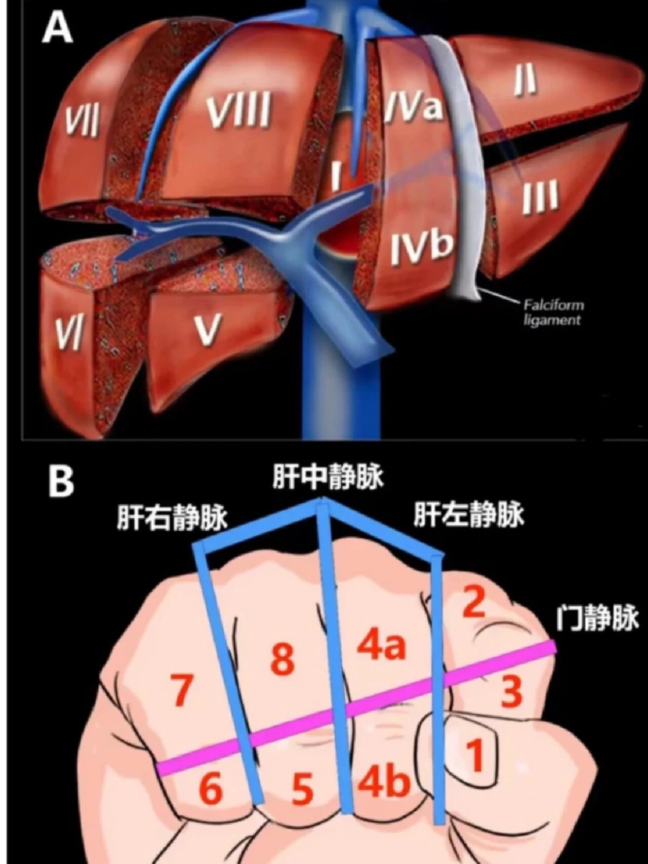 肝脏的三大静脉:肝左静脉,肝中静脉,肝右静脉
