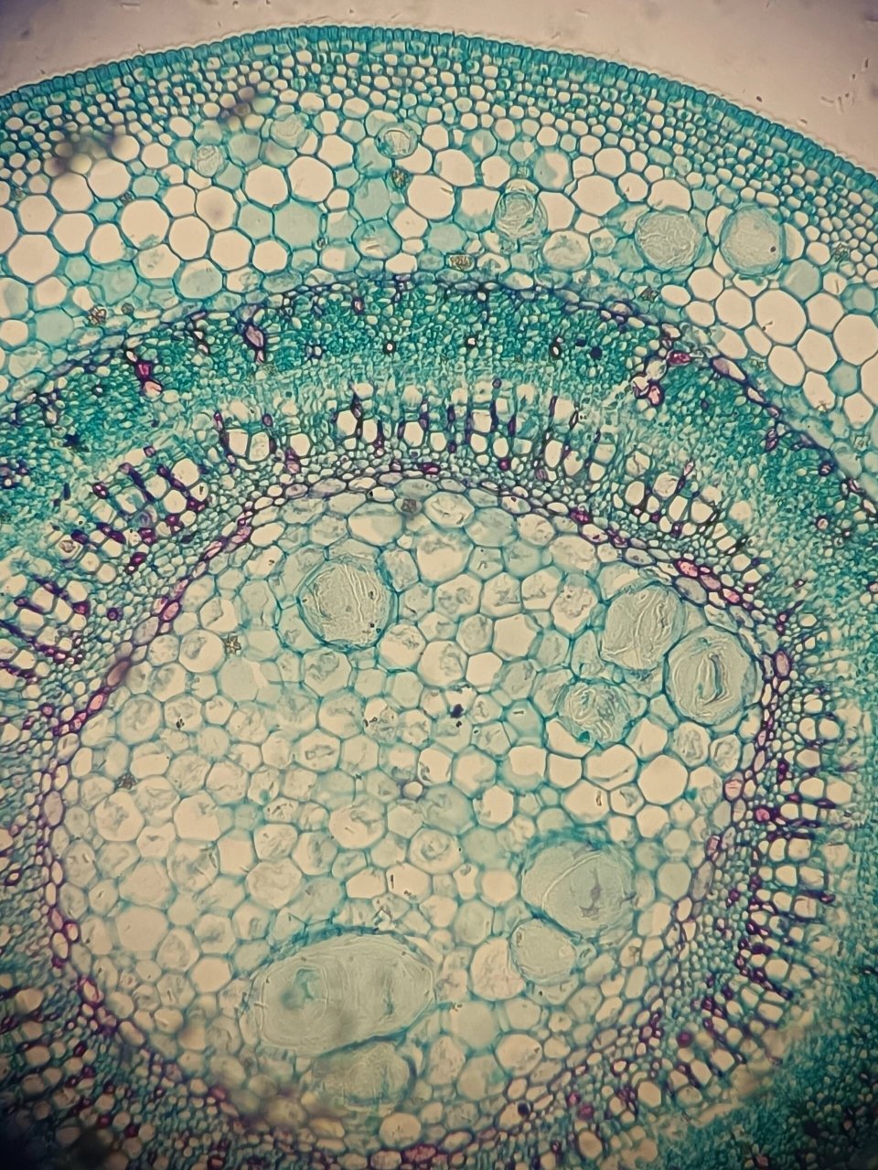 椴树茎横切片显微结构图