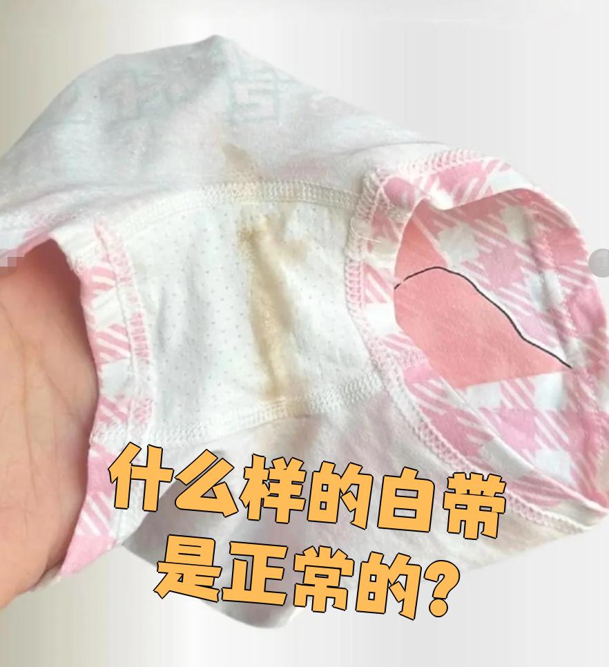 正常的白带是透明或淡黄色的,质地清爽,没有黏腻感,也不会有难闻的