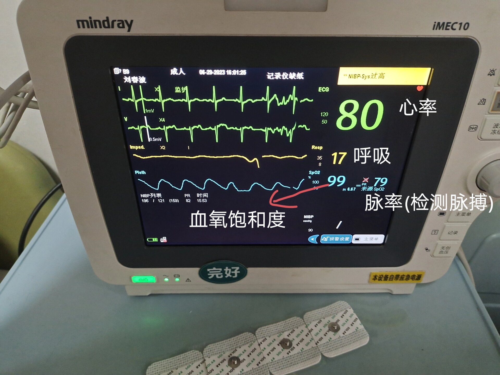 心电监护仪(五导联)详解