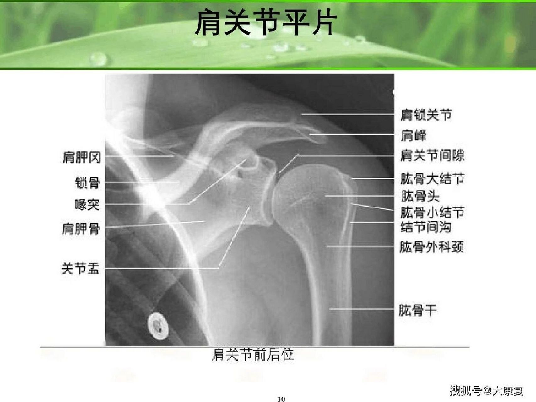 肩关节压痛点的图图片