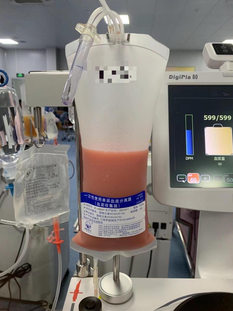 因为每个人的身体状况不一样 所以血浆颜色也不一样 像图31566