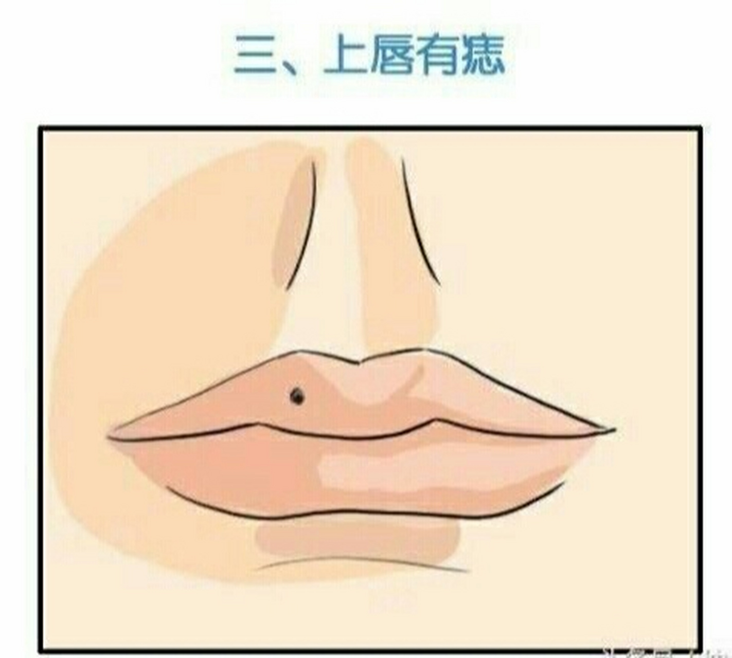 嘴唇上长痣好不好 痣长在上嘴唇 其为人热///青奔放,对待感情热烈而