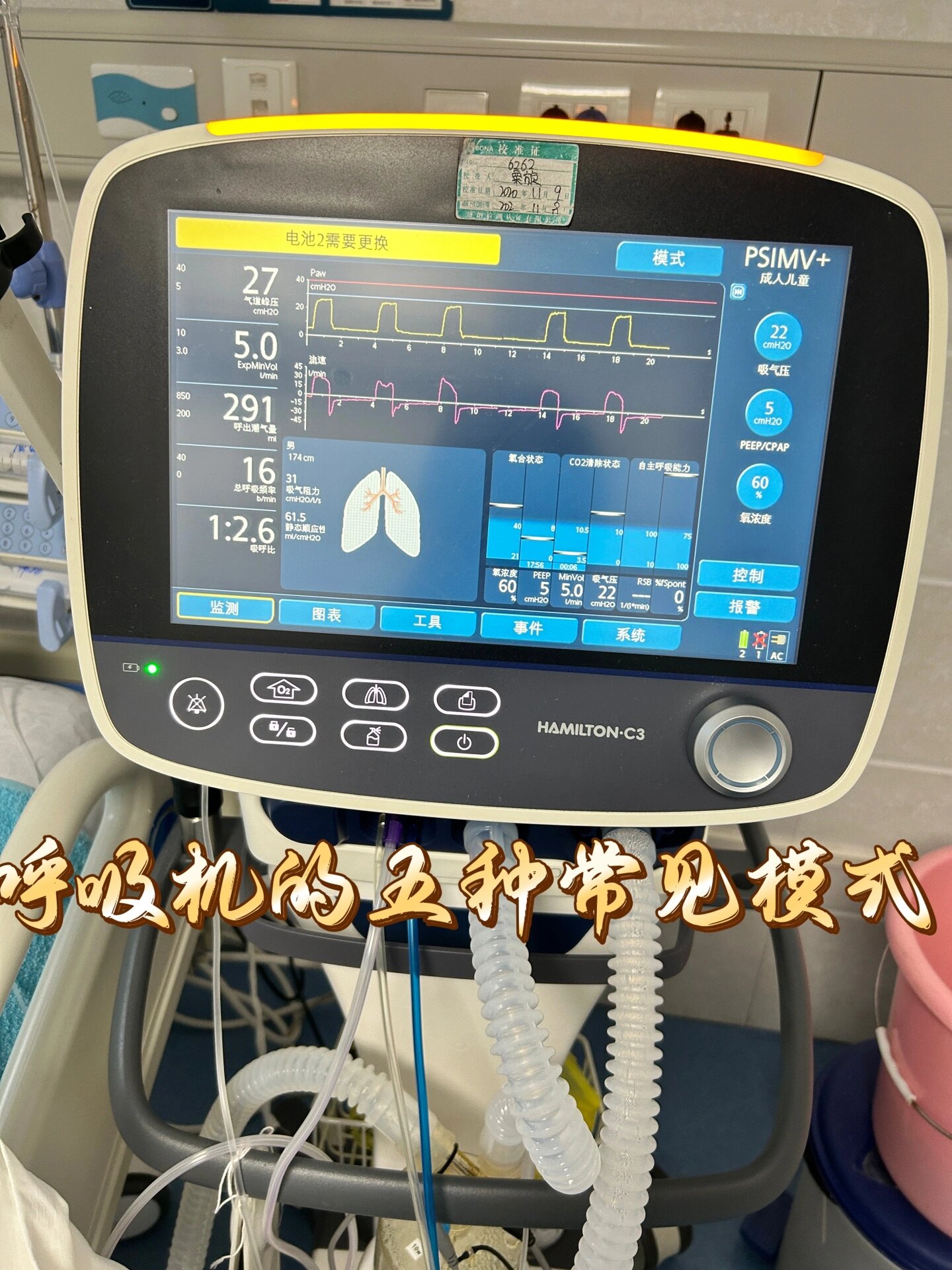 基础版|呼吸机五种常见模式