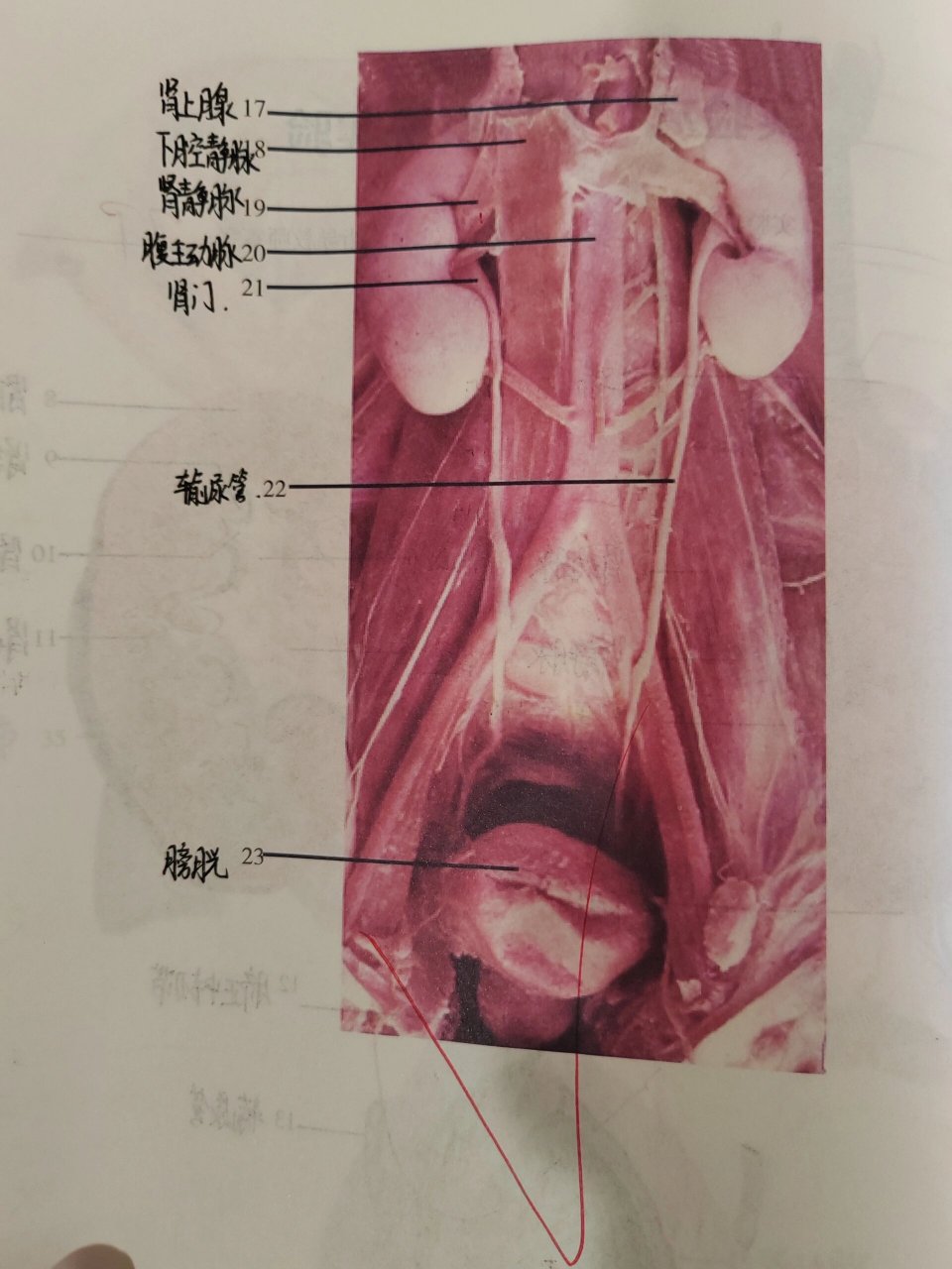 肾门体表投影为图片