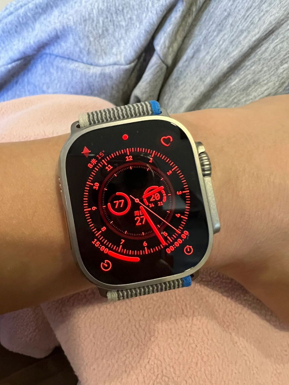 苹果手表变红了 突然iwatch就成这样了 改变表盘也没用 请问怎么了