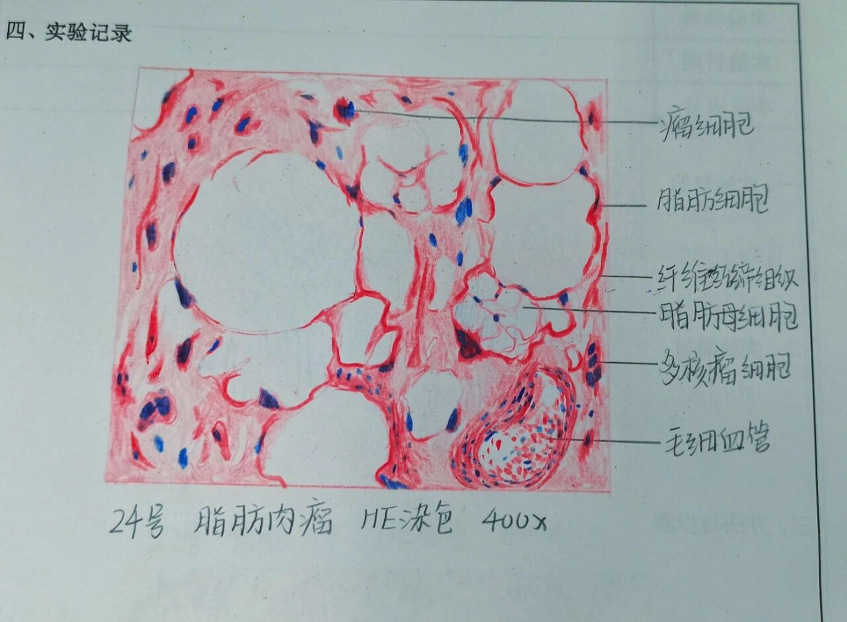 脂肪细胞手绘图图片
