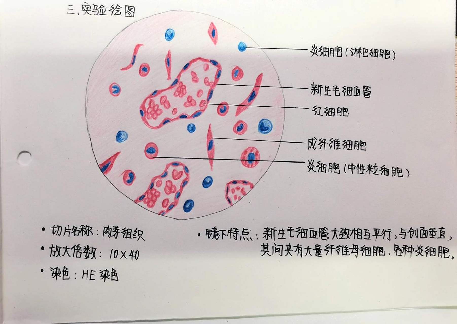 肉芽组织镜下手绘图 肉芽组织镜下手绘图