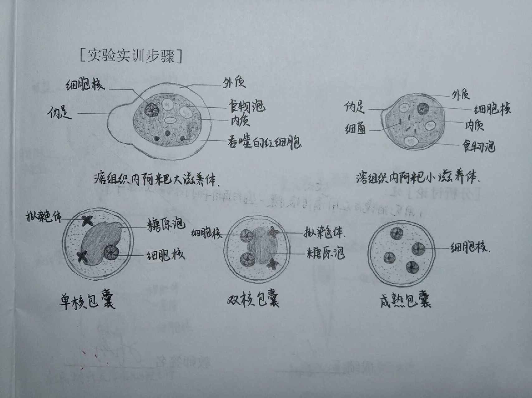 十二指肠钩虫口囊手绘图片