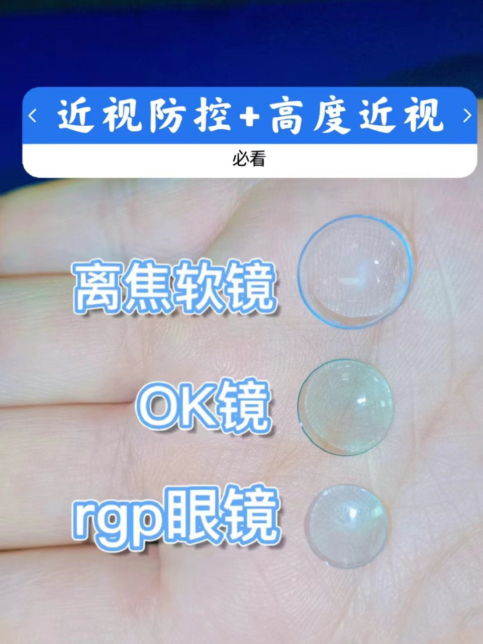 离焦软镜,ok镜,rgp,分别适用哪些人?