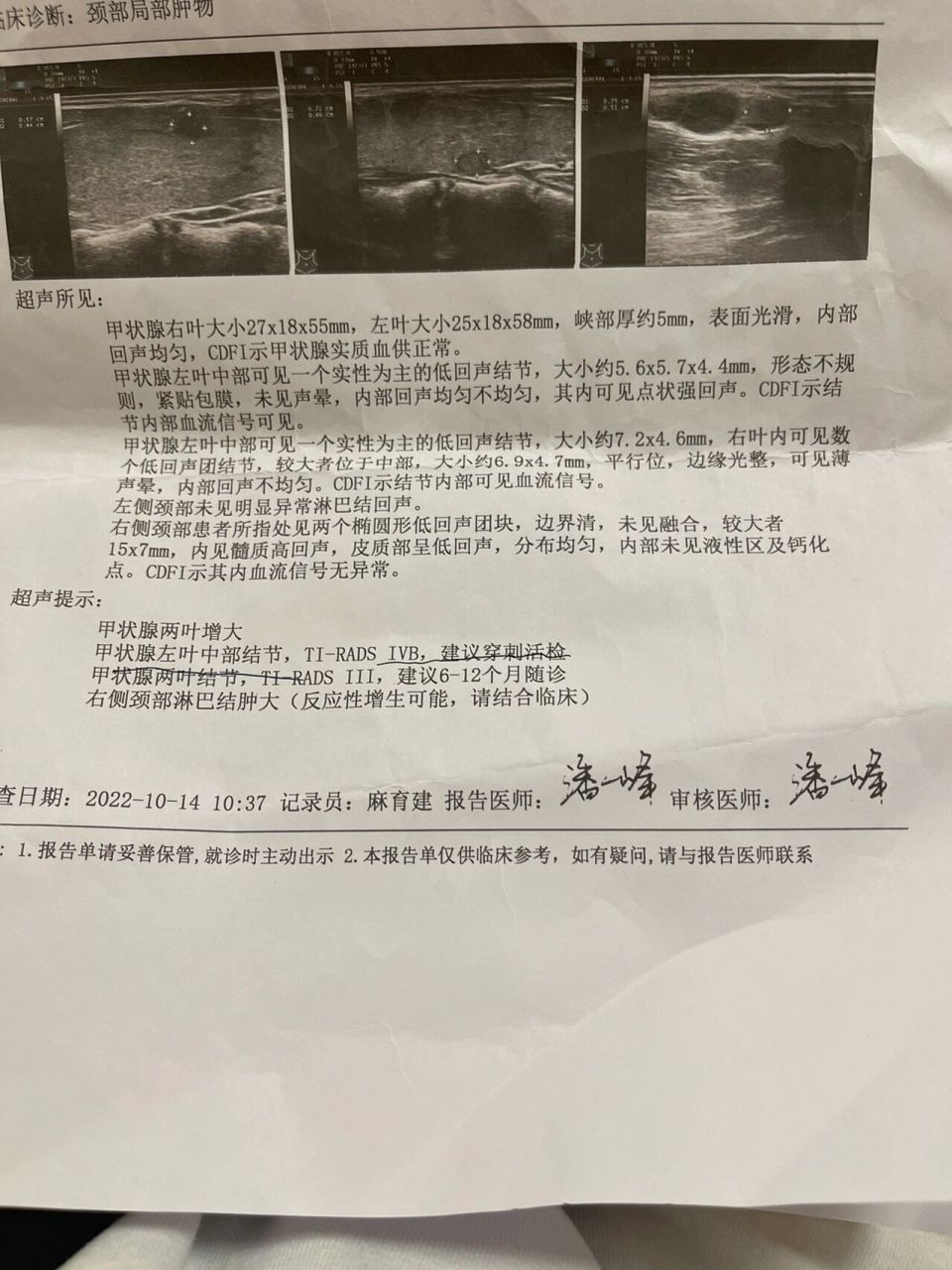 甲状腺结节穿刺活检已做 上周因为脖子右侧淋巴结肿了去医院检查,顺便