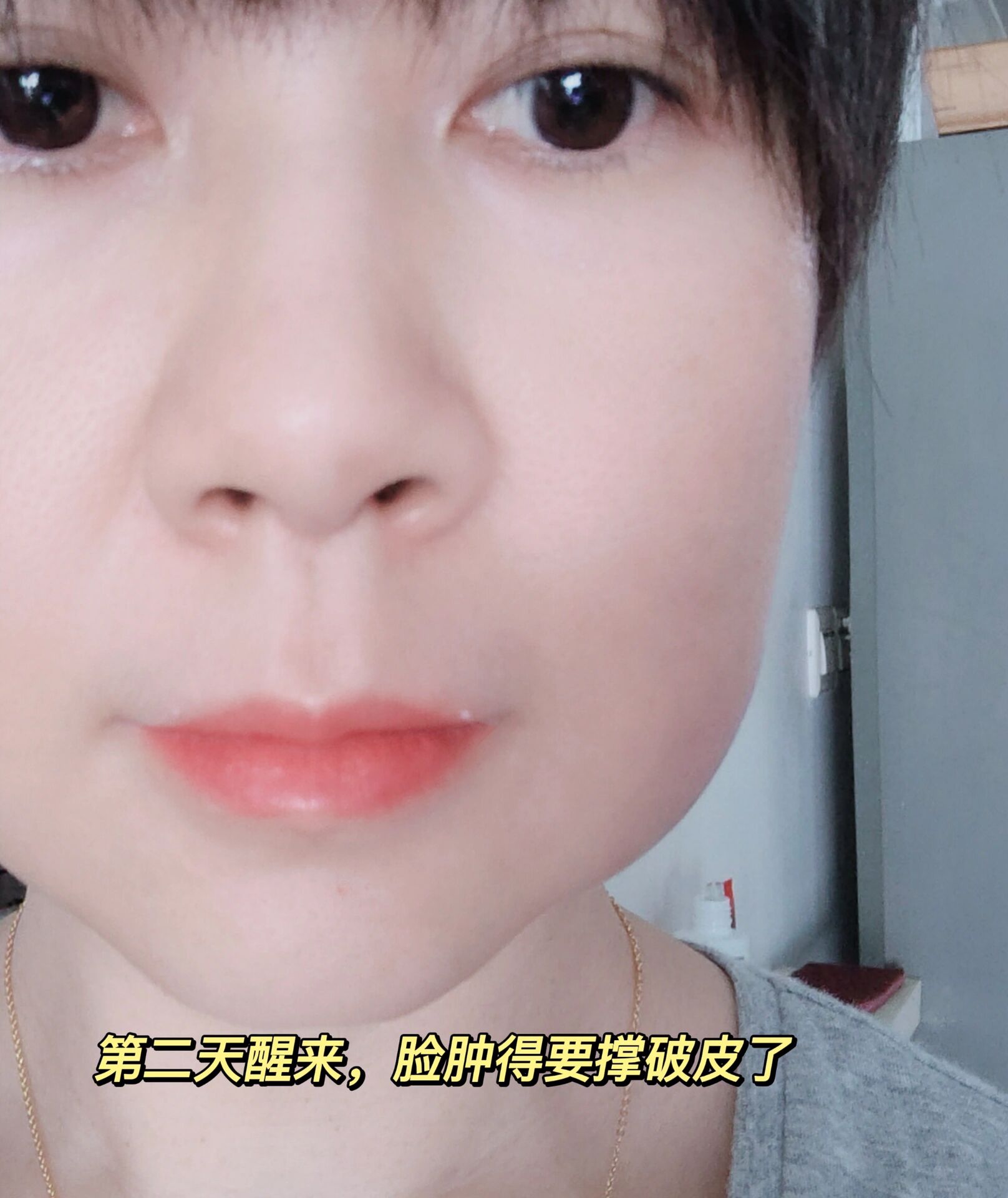 终于能吃点蛋糕了07 去洗了个牙,就下定决心把4颗智齿一次性都拔掉