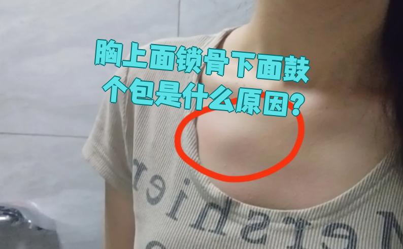 胸上面锁骨下面鼓个包,可能和皮脂腺囊肿,毛囊炎,淋巴结肿大这些