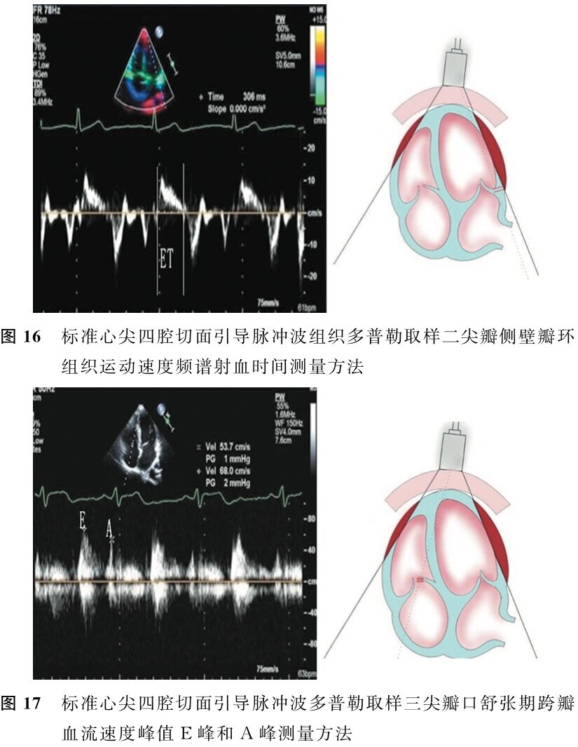 心脏超声标准切面 对应教材p59. 1.