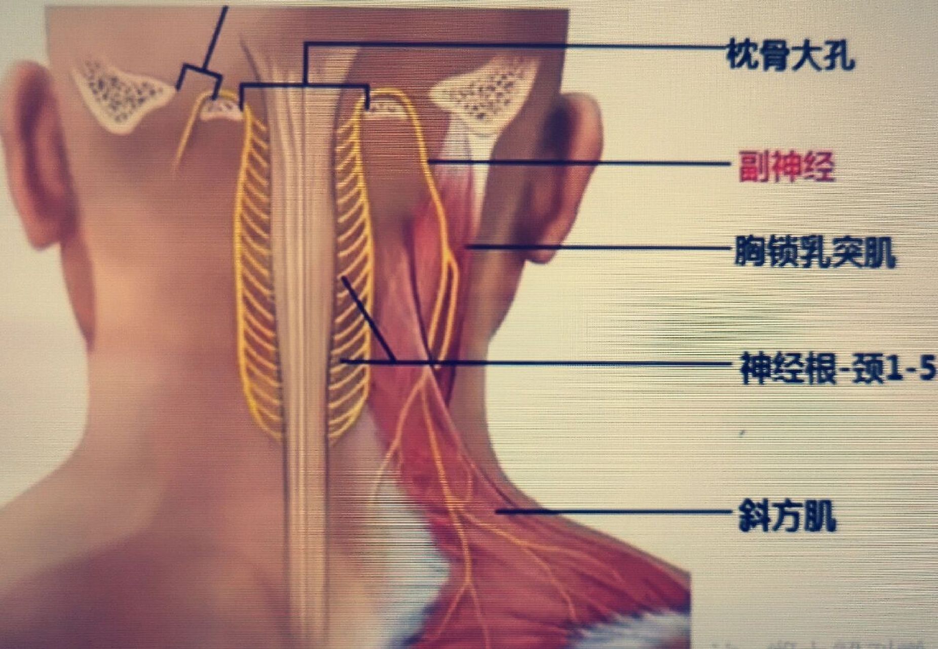 延髓解剖位置图片