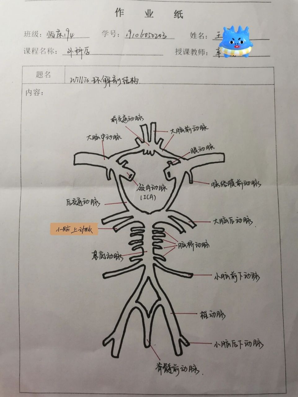 大脑动脉环简图图片