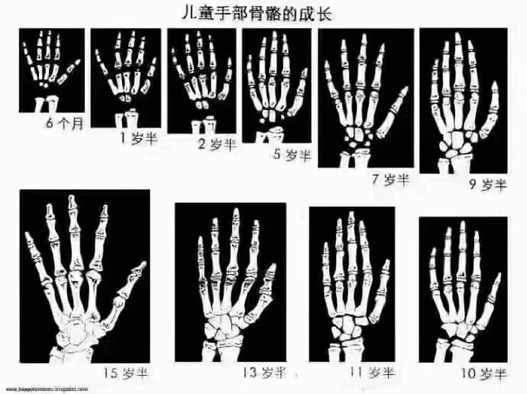 儿童手部骨骼成长