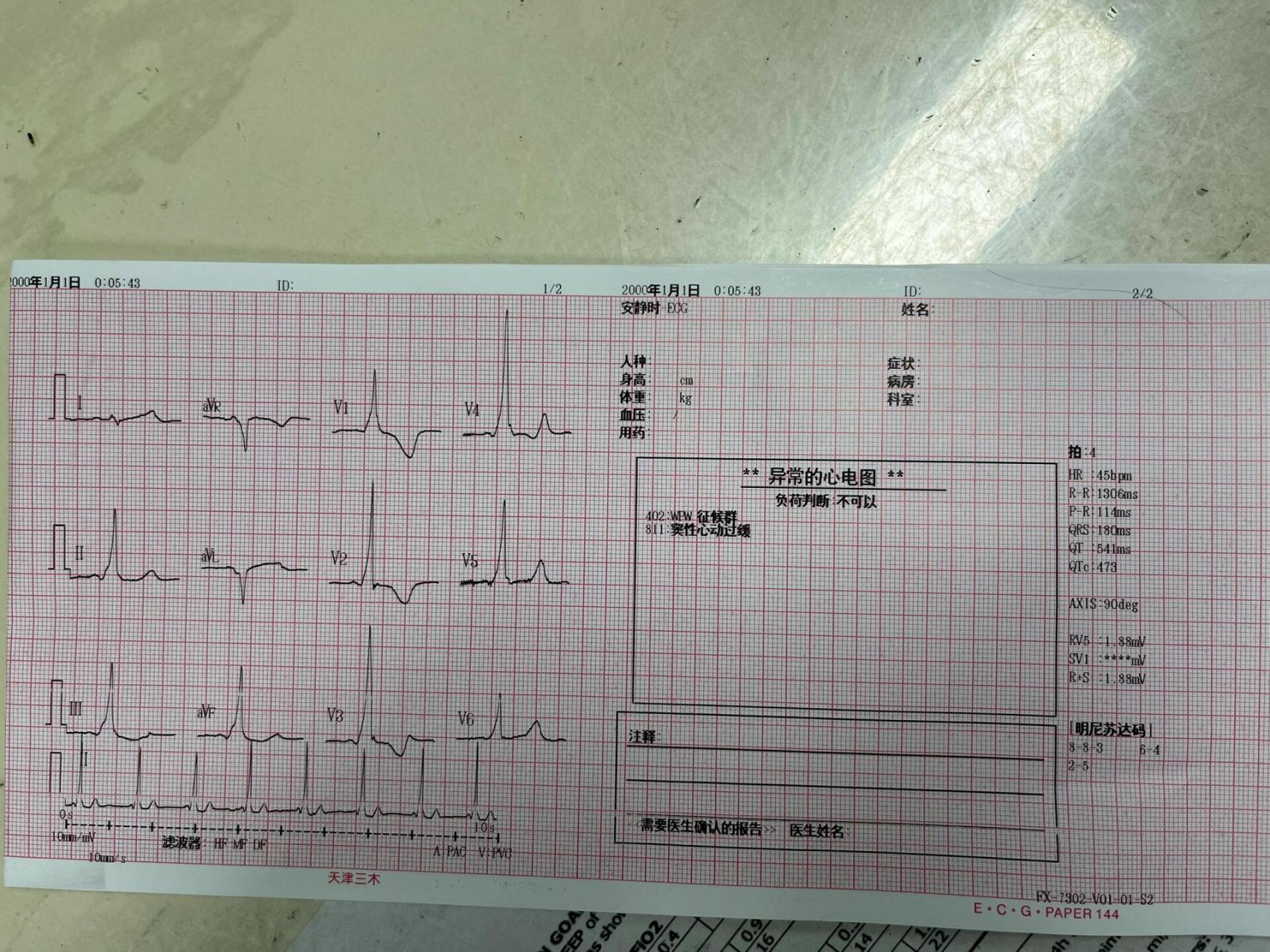 wpw综合征 继续学习