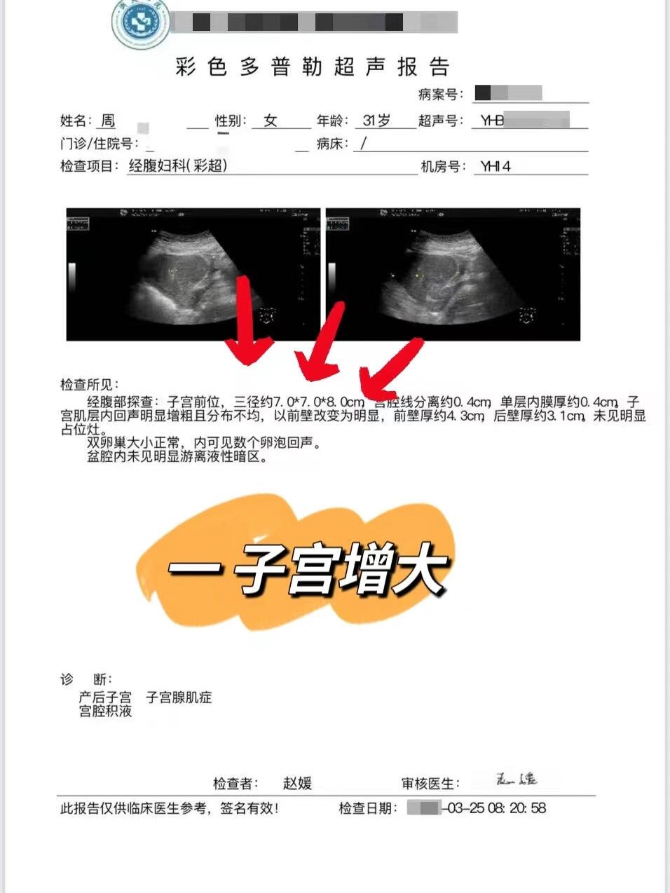 子宫腺肌症严不严重