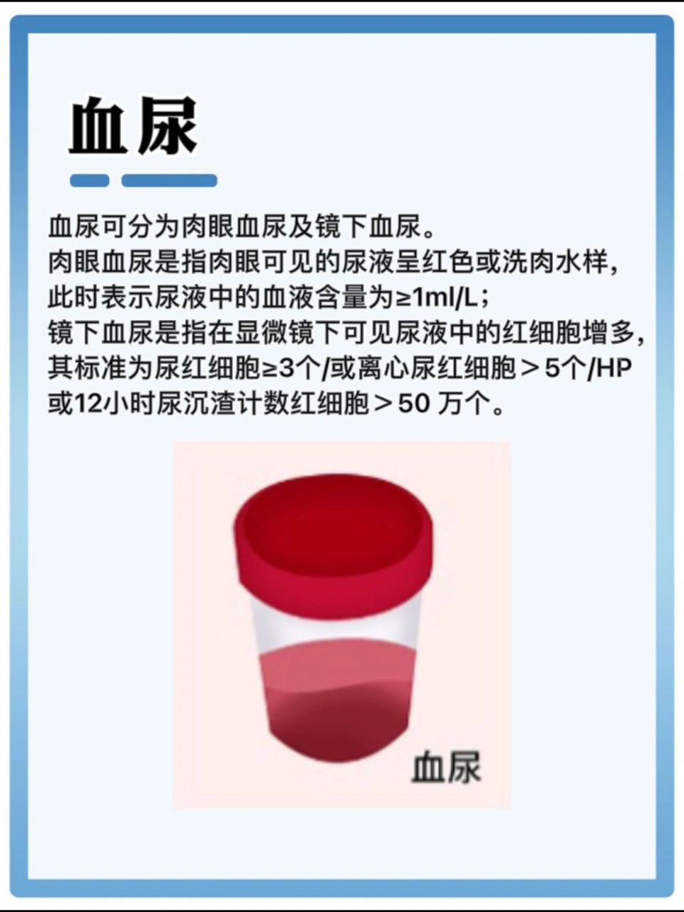 肉眼血尿是指肉眼可见的尿液呈红色或洗肉水样,此时表示尿液中的血液