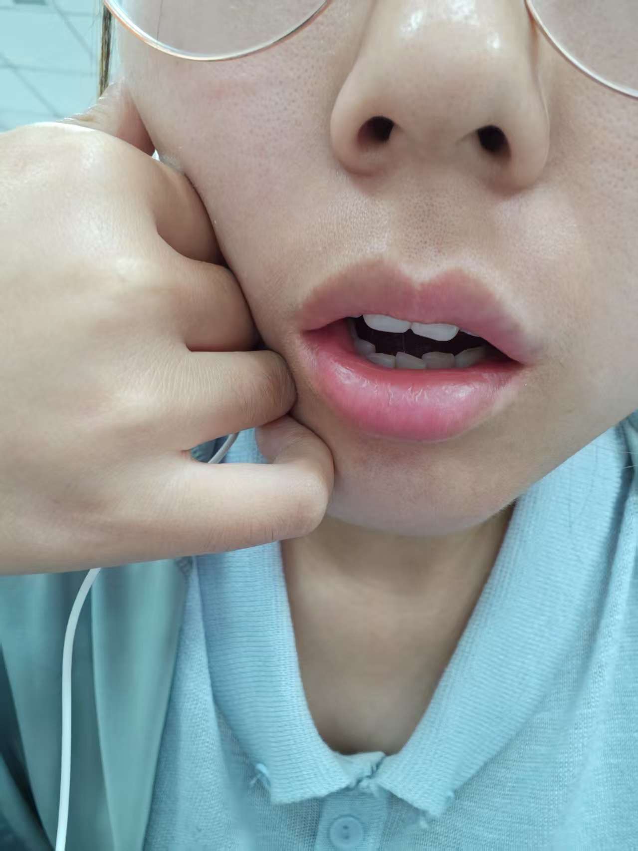 人为什么打呵欠会流泪为什么在线 人为什么打呵欠会流泪为什么在线