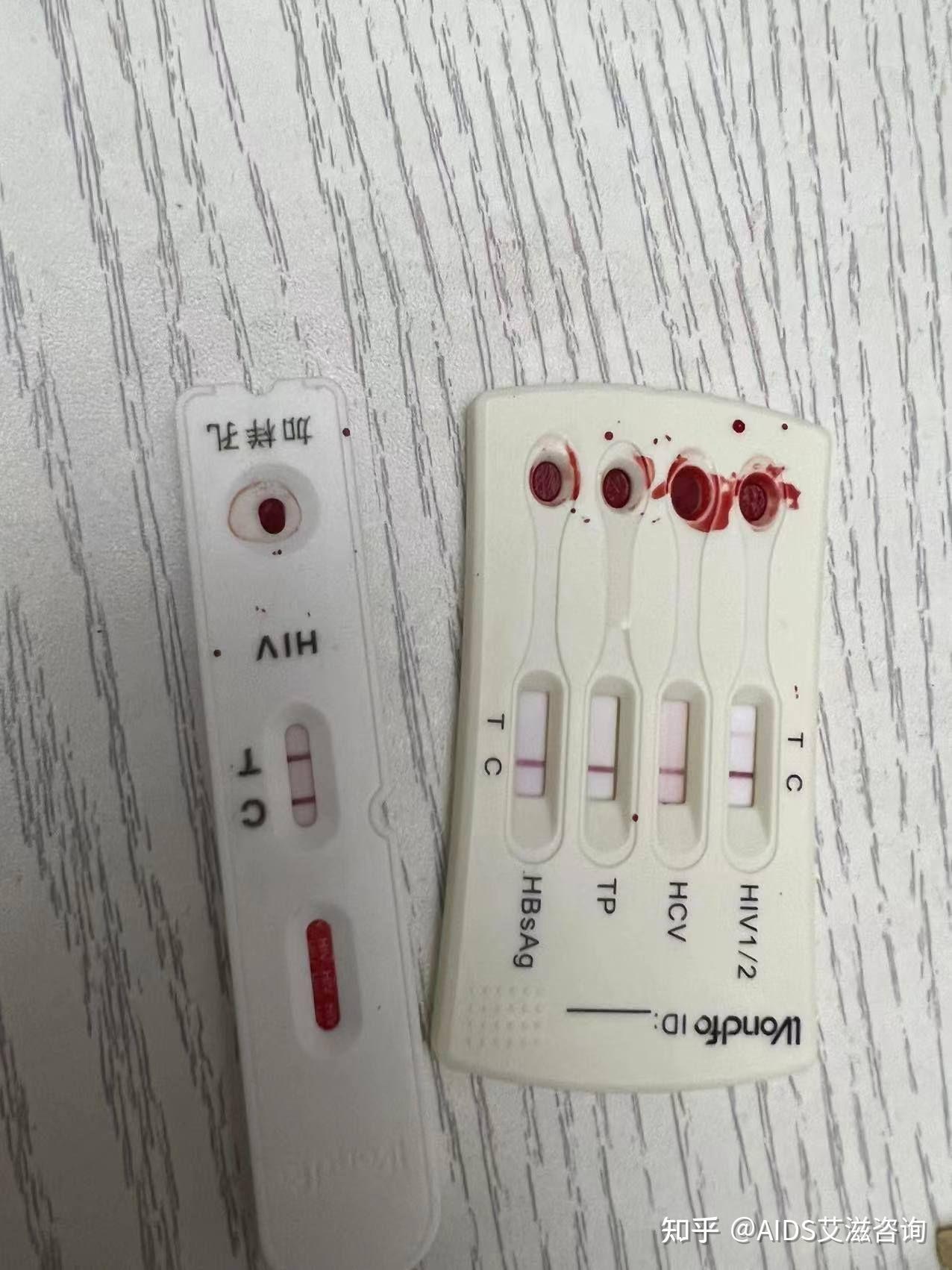我这hiv试纸15分钟出现一条隐约的线这是包埋线吗