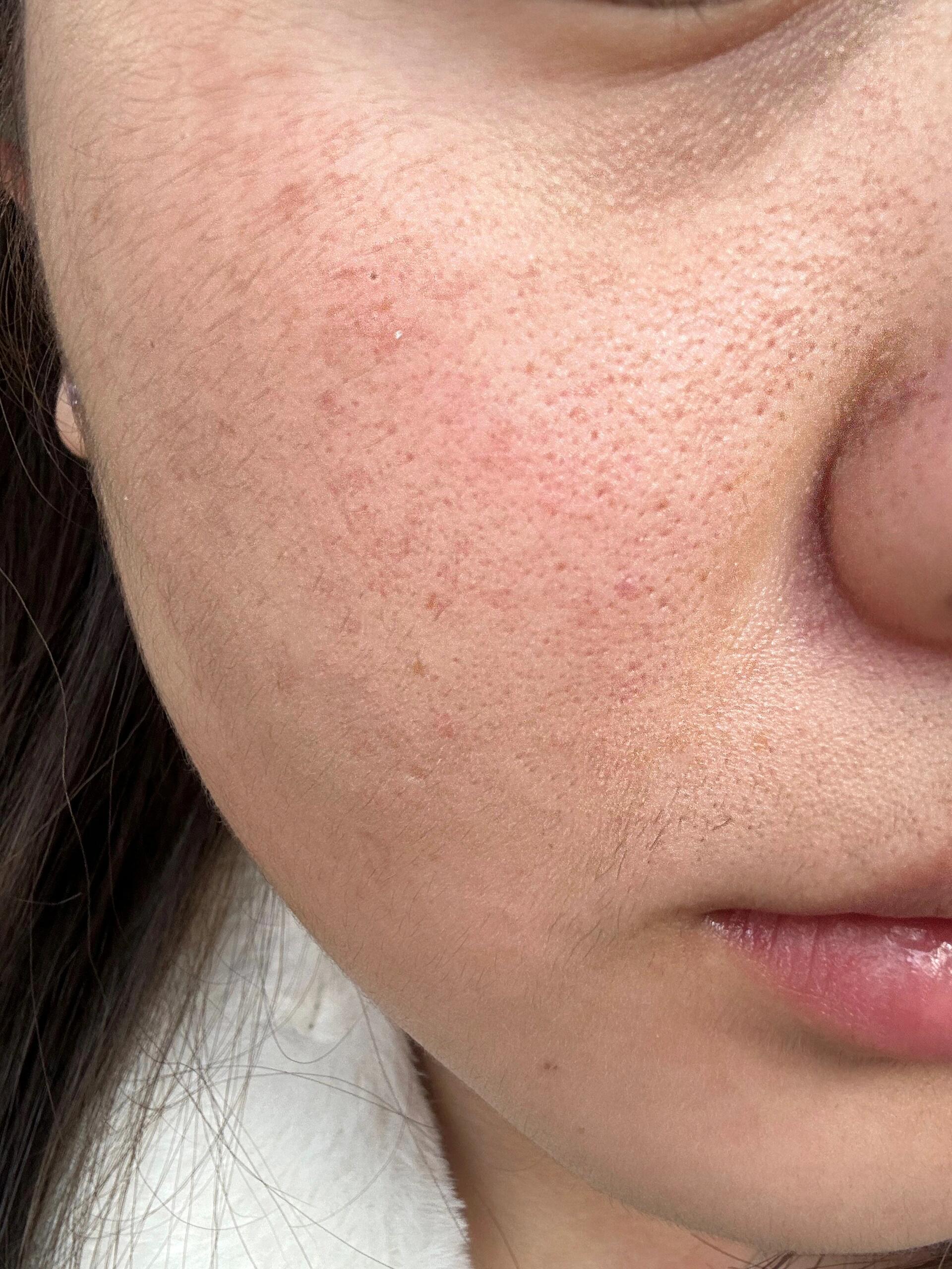 我才二十多岁已经这样了