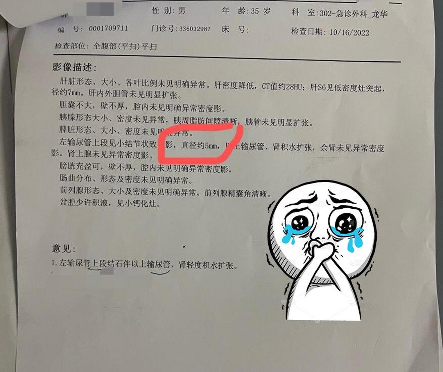 狄激光碎石真实经历图片