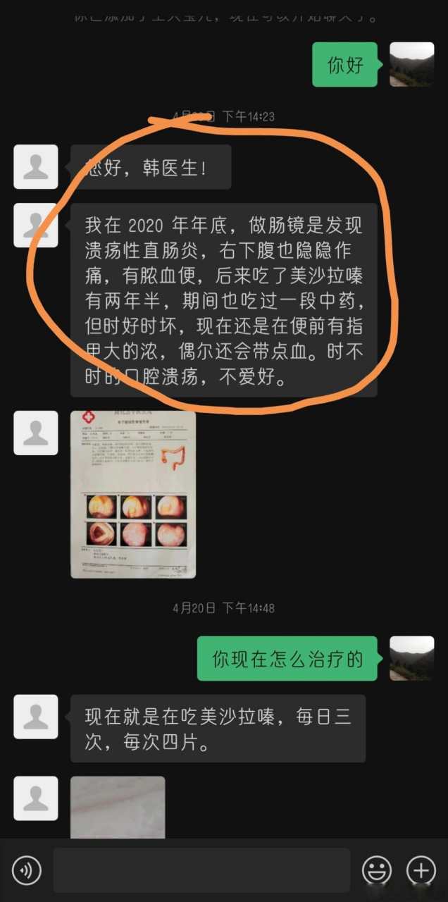 3月份接诊了一位溃疡性结肠炎,自求在当地中医治疗无效,长期口服美