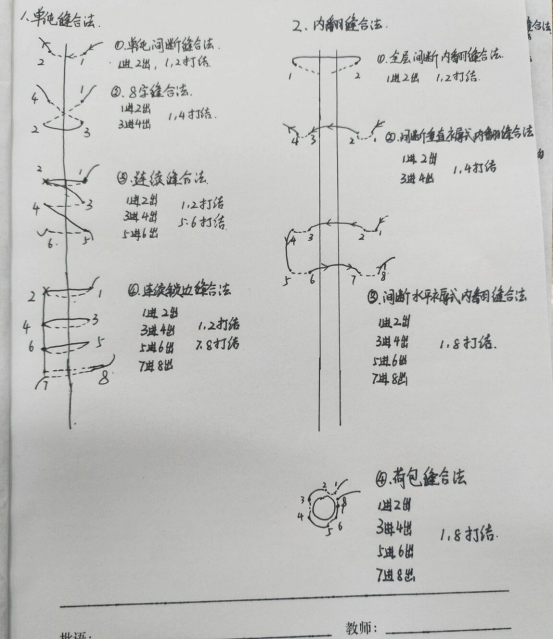 螺旋缝合方法图解图片