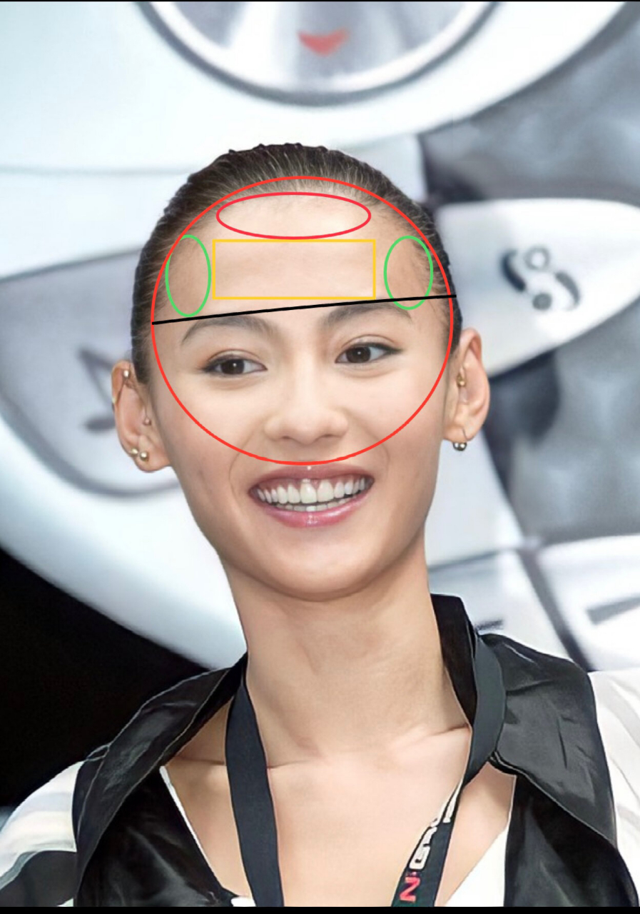 面部美学-张柏芝额头 首先公认的好看的额头:清晰的线条,眉骨,额结节