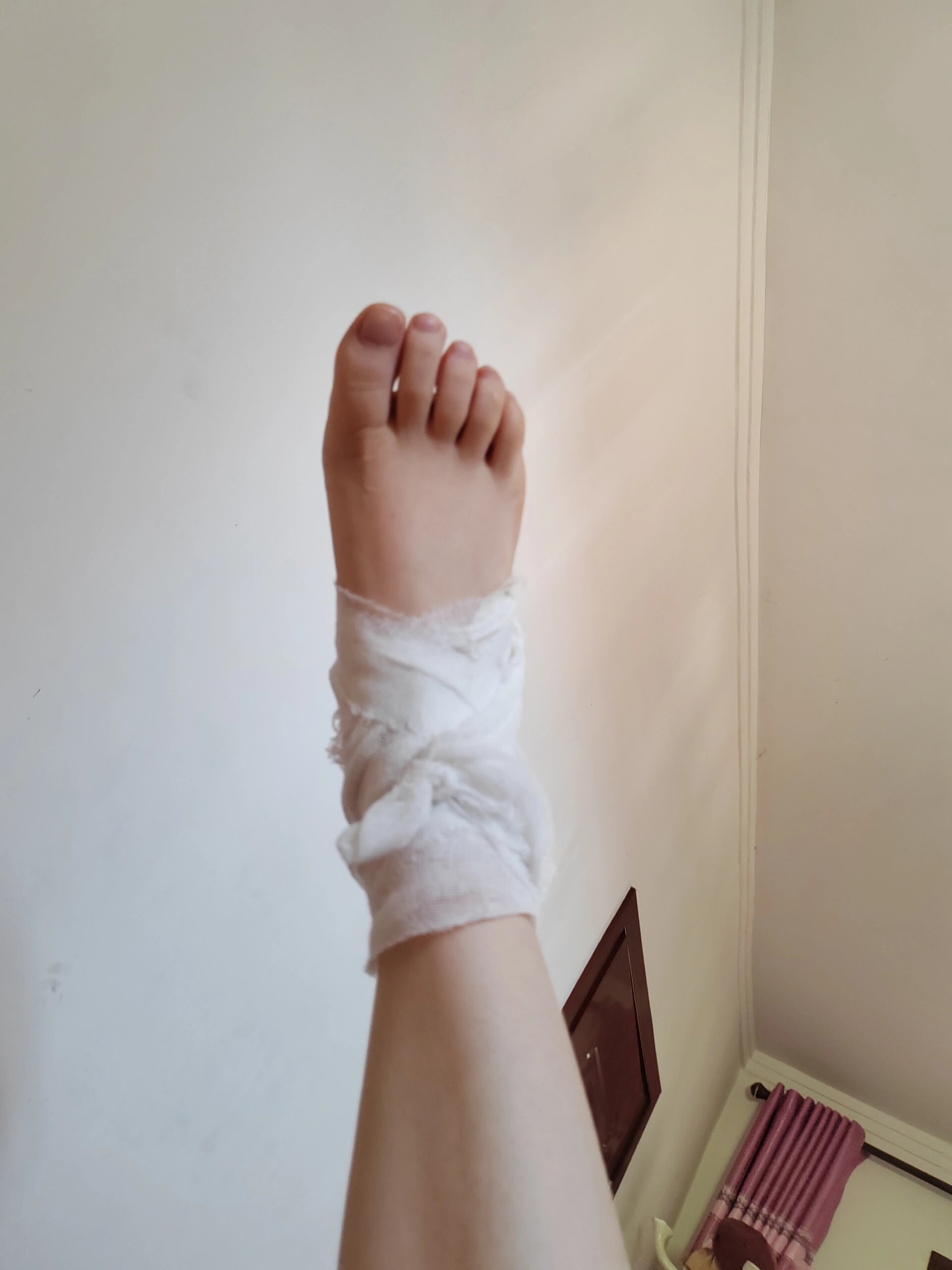 崴脚千万别不当回事,四个月了走多了就疼