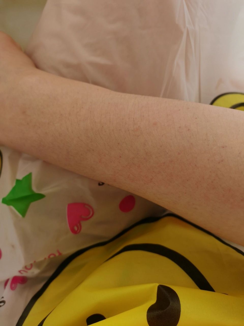 原相机拍的从胳膊到手臂长满了小红点,不痒不痛.