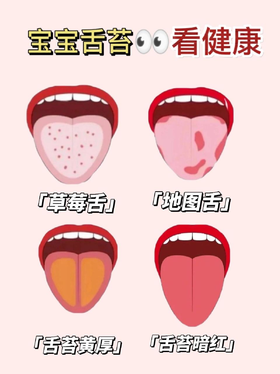 9299宝宝的身体情况,往往能通过舌相来判断,健康的宝宝舌头是淡