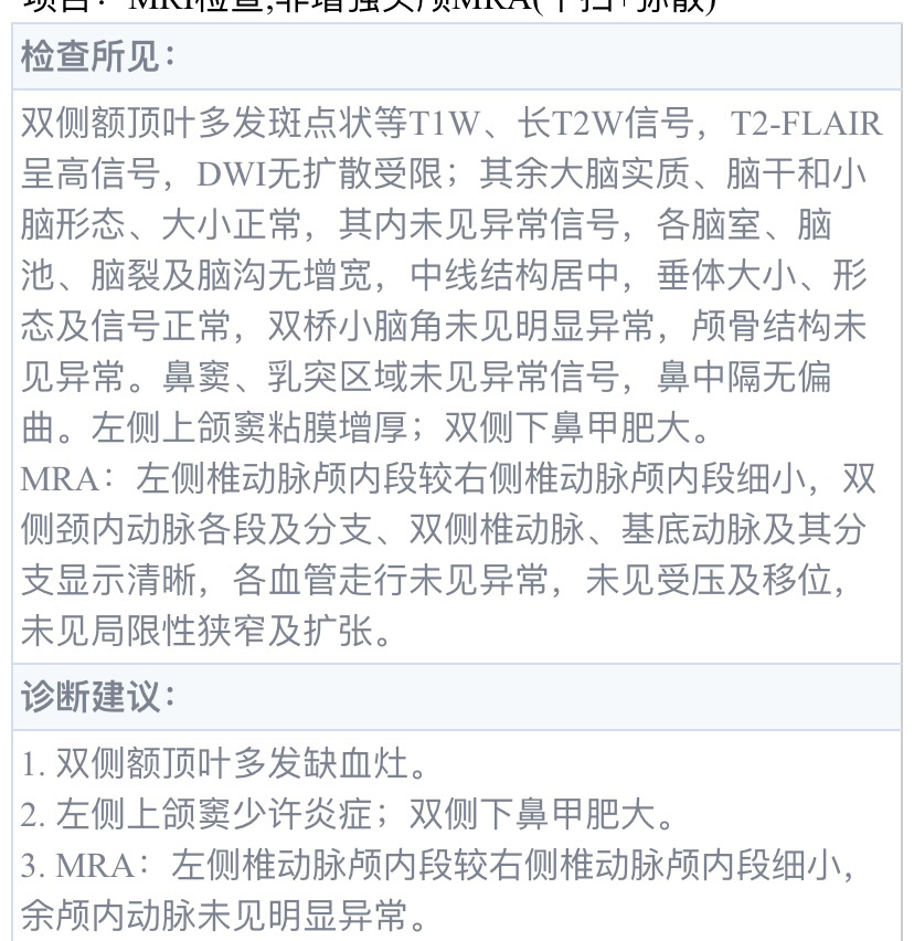 偏头痛,双侧额顶叶缺血灶怎么治疗 去年带爸爸去医院照了核磁共振,查