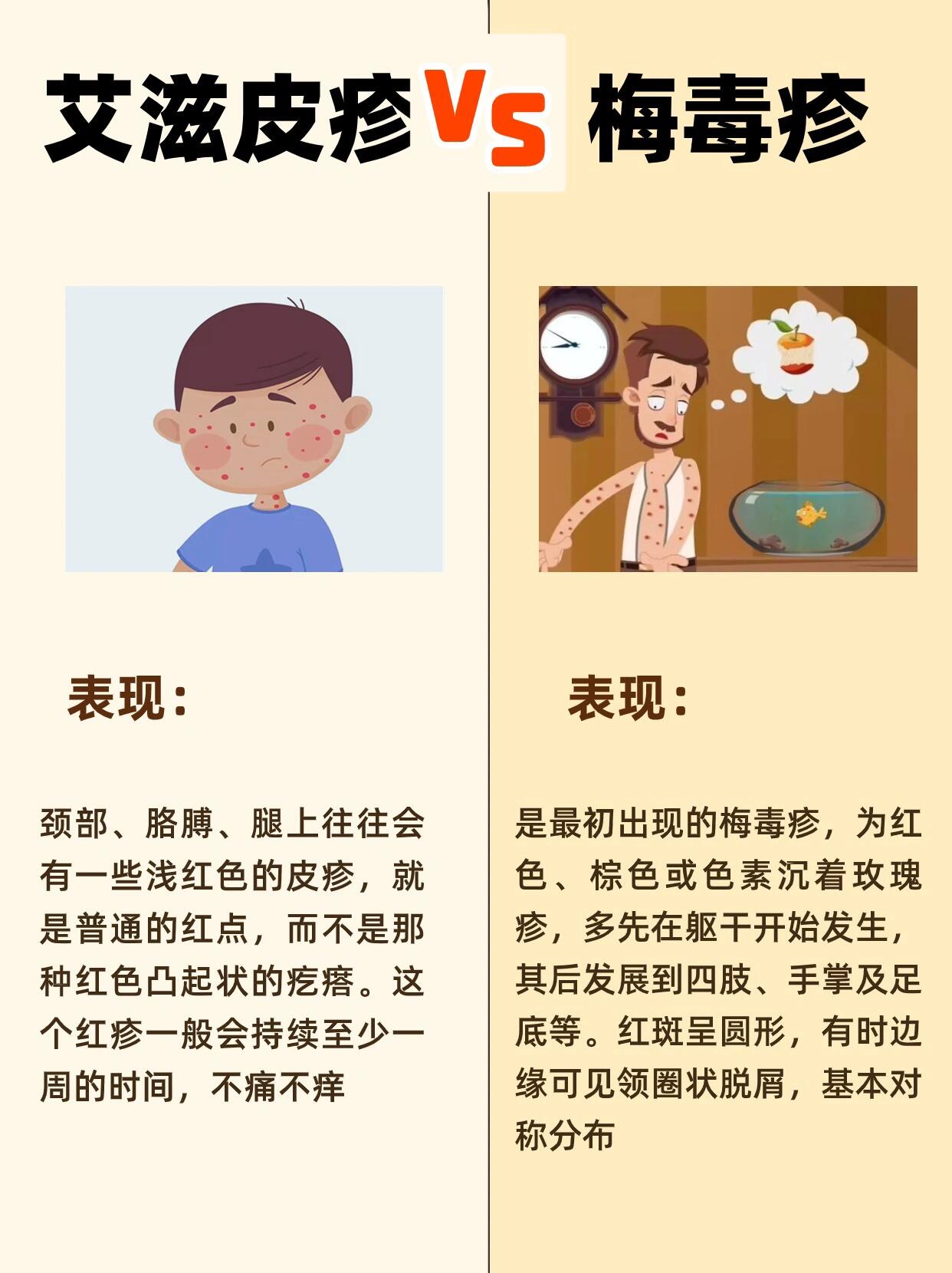 艾滋病先从哪里痒警惕图片