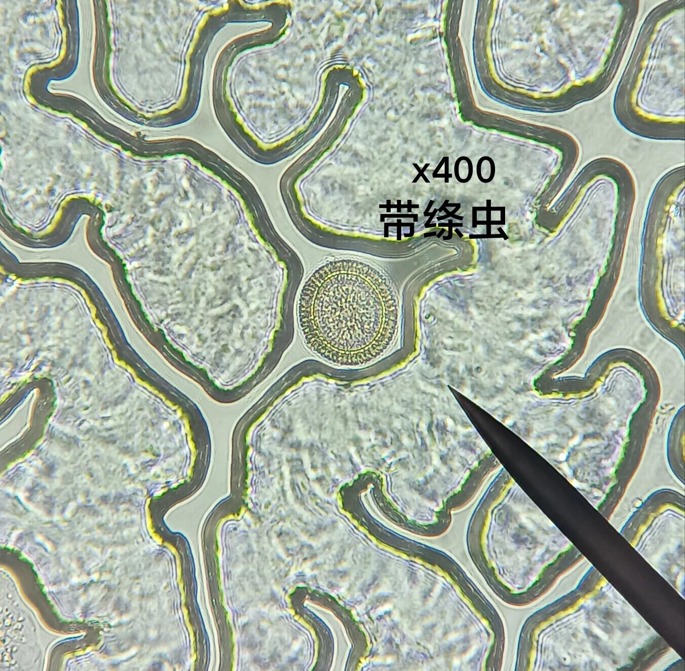 显微镜下蛔虫卵图片图片