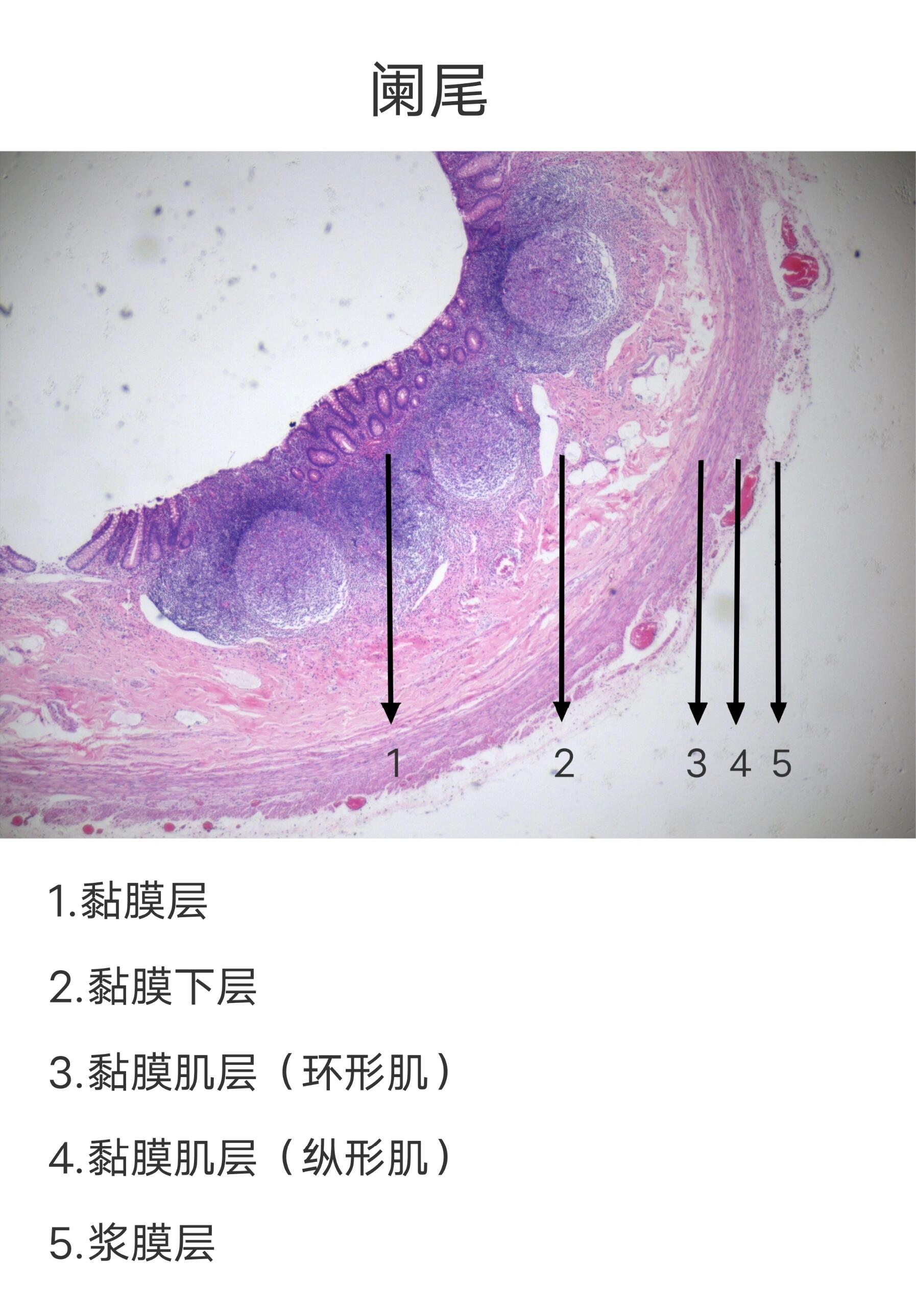 阑尾组织分层图片