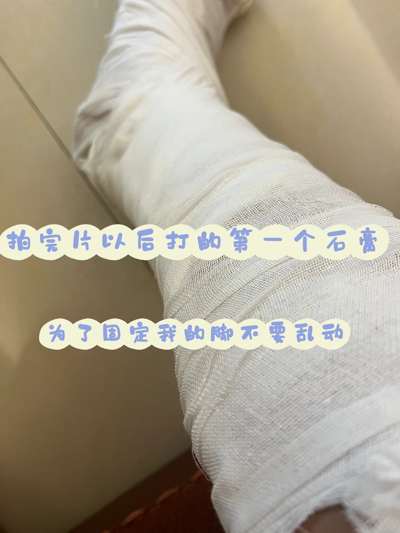 1马上去医院挂了骨科准备拍片03 医生看我脚踝肿了一圈初步判断是