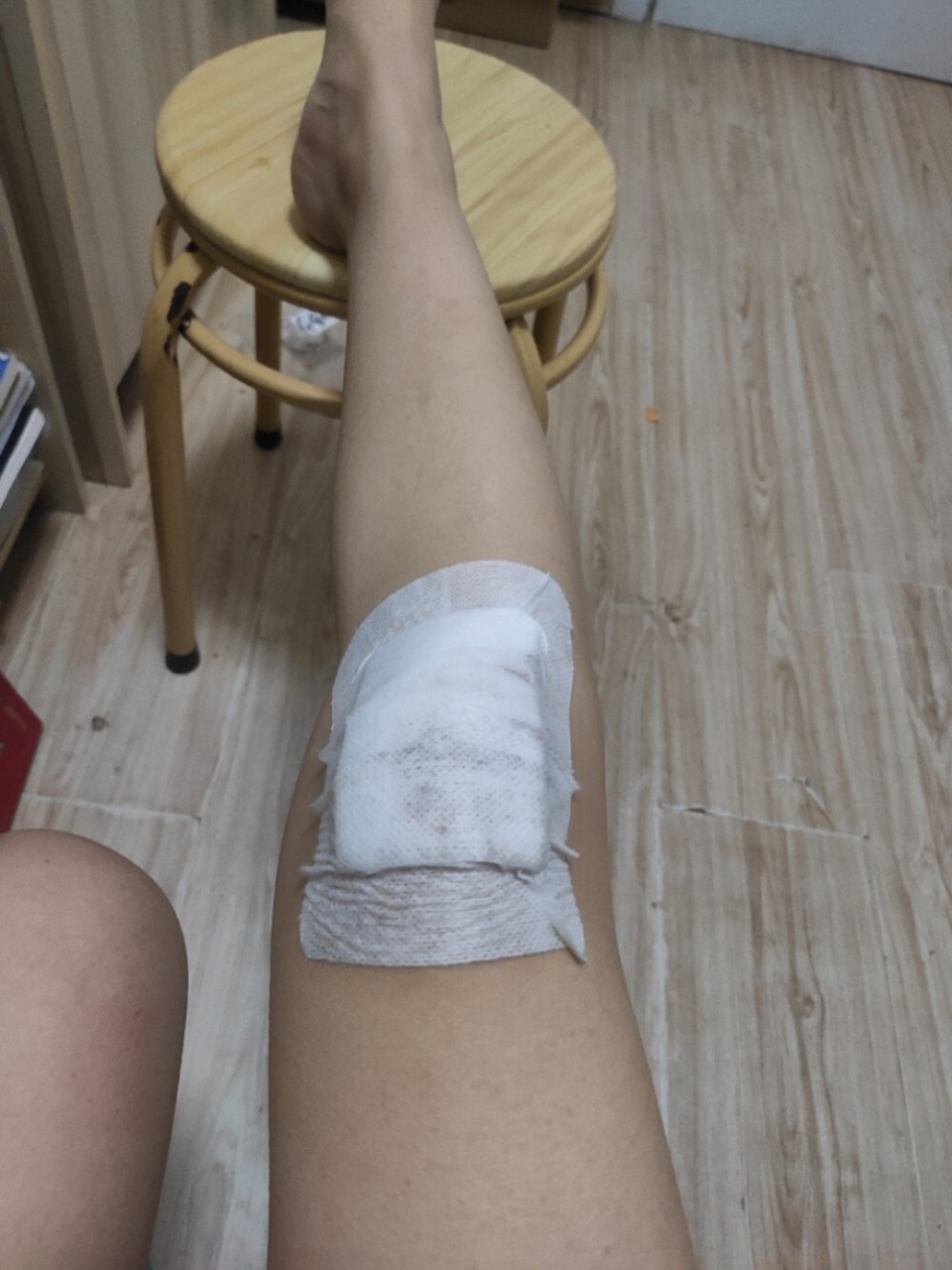 今天腿真的磕伤了,我该难过还是开心 今天出门,没看到脚下不平, 一下