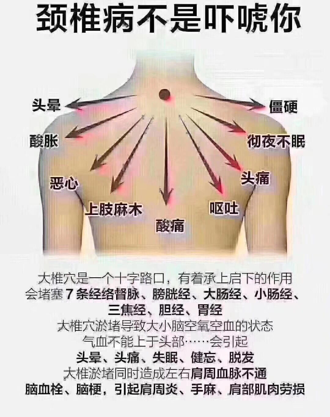 做身体出痧出的颜色分为6种  1 黑痧 寒; 2 紫痧 又毒又堵; 3