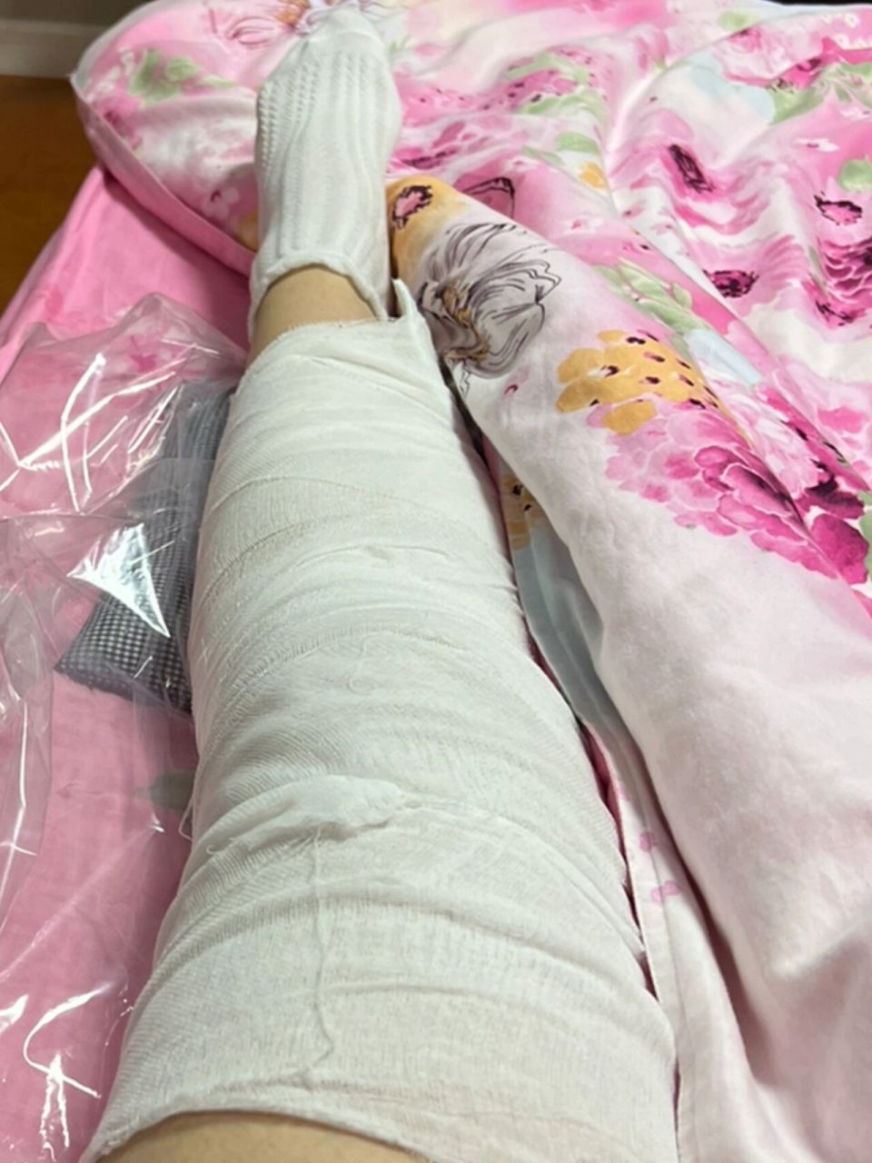骨折了之后睡不着好痛苦啊 今天正电影院厕所踩空膝盖骨错位了,打上了