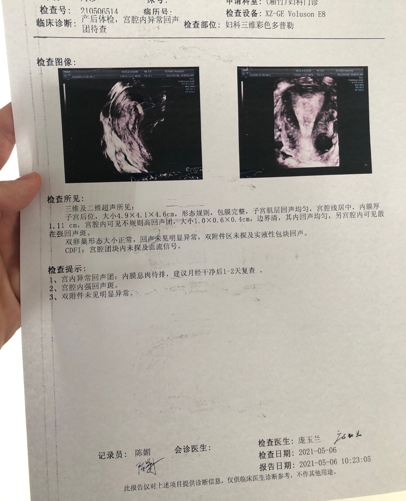 产后7个月,宫内残留物 额,不知道之前被这个胎盘胎膜残留物折磨了多久