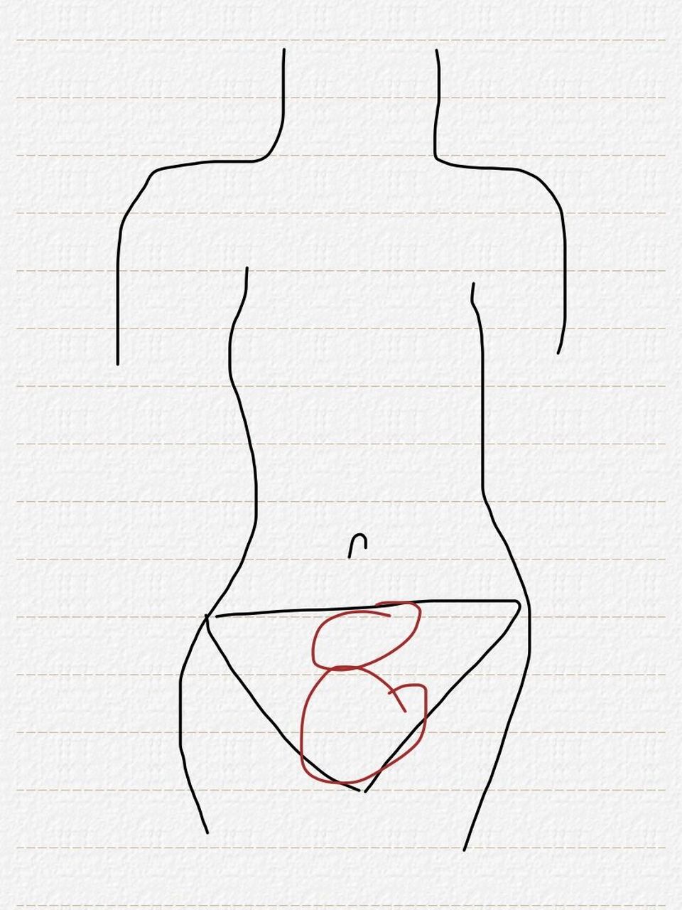 孕16周 2w 下腹部到三角区会隐隐作痛 如图 最近这两天 下腹部到三角