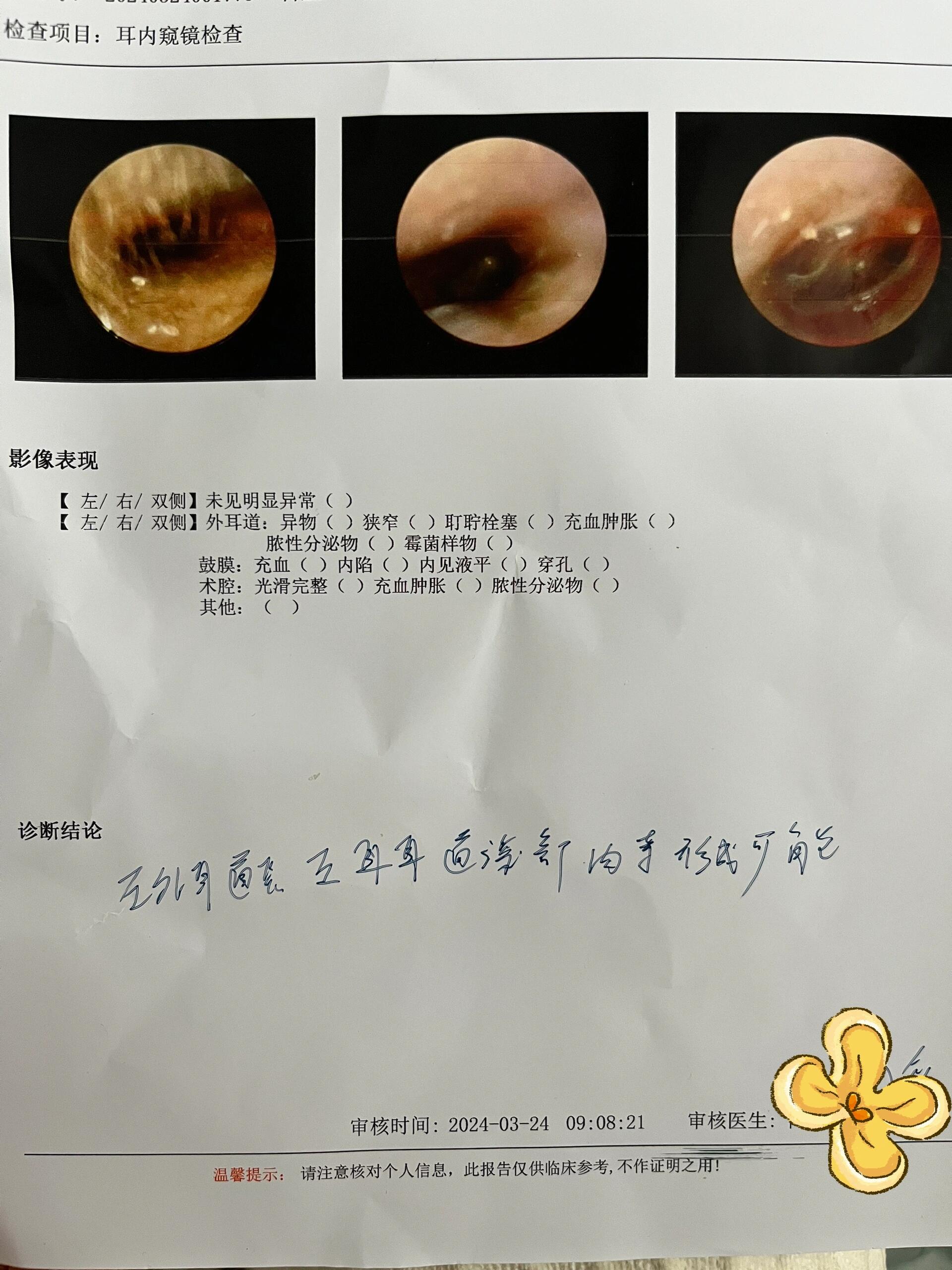 外耳道炎 又一人间疾苦 5天前耳朵太痒了挖了耳朵,挖太深不小心伤到了