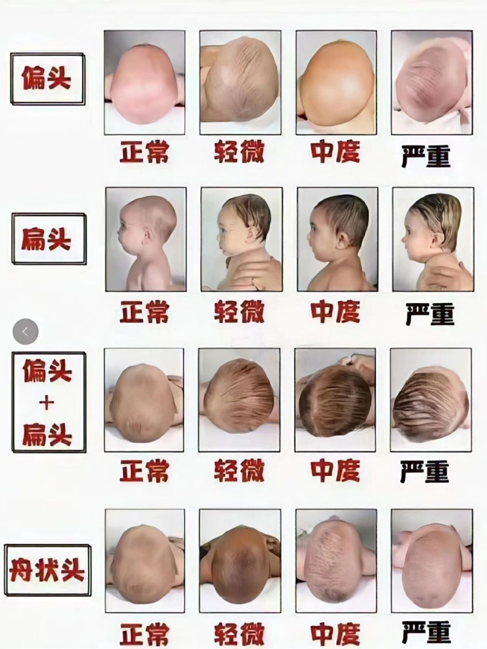 新生婴儿头型图片大全图片