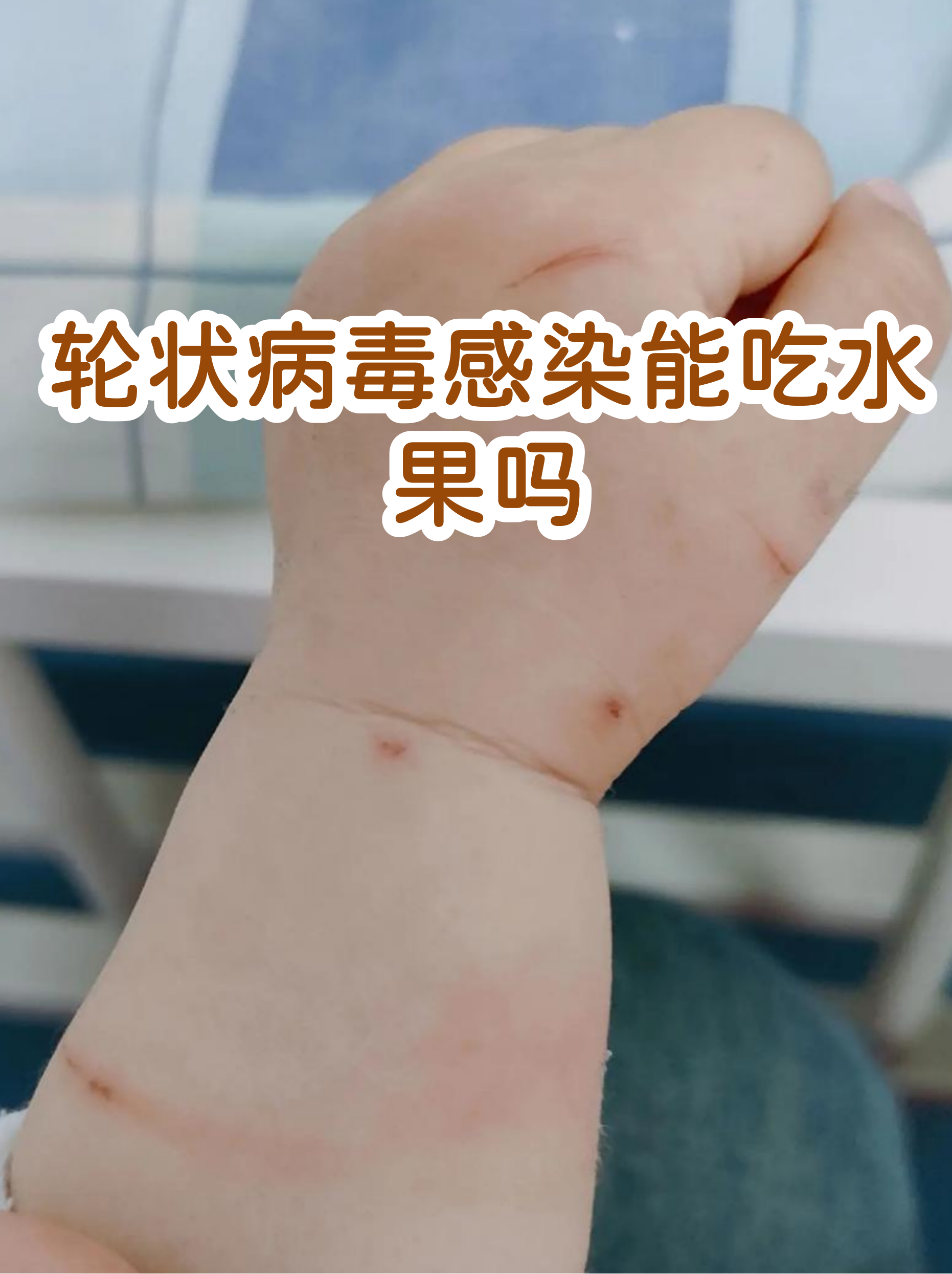  病毒水果的图片(疱疹病毒图片)