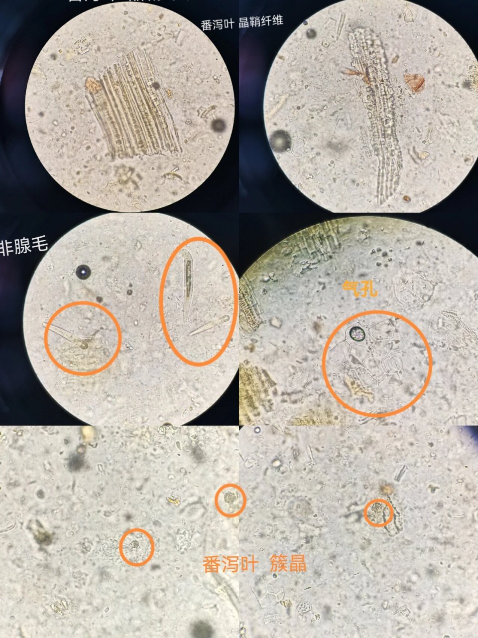 草酸钙方晶显微图图片